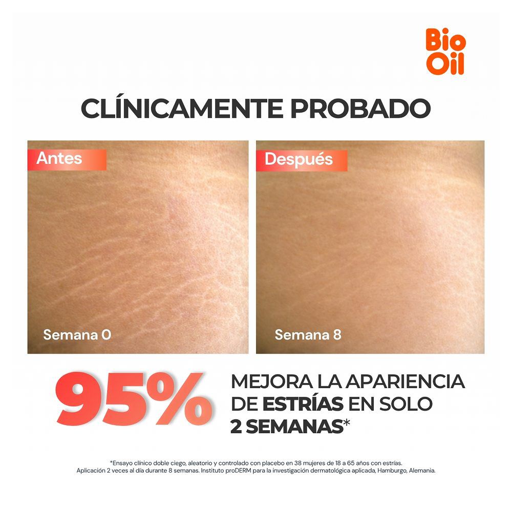 Aceite-Bio-Oil-60-mL-imagen-2