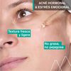 Serum-Anti-imperfecciones-Hyséac-Piel-Nueva-30ml-imagen-3