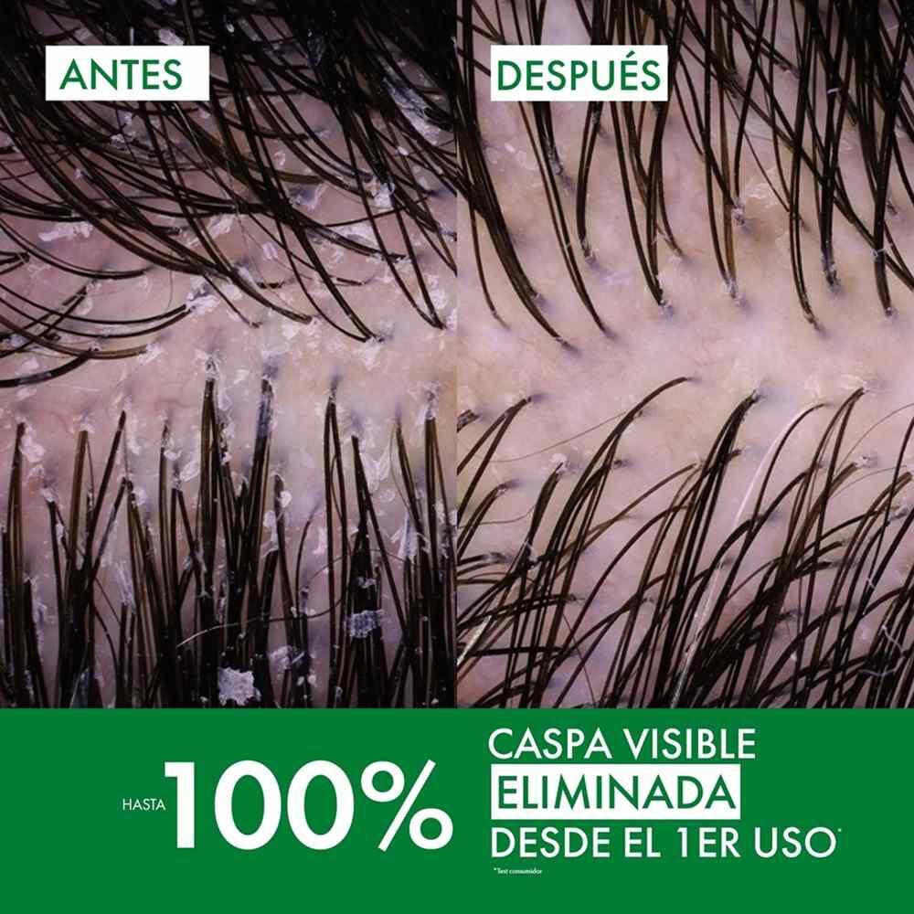 Dercos-Shampoo-Anti-Caspa-DS--95ml-imagen-3