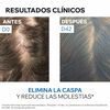 Shampoo-Anticaspa-DS-Hair-200ml--imagen-5