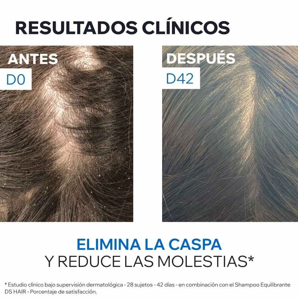 Shampoo-Anticaspa-DS-Hair-200ml--imagen-5