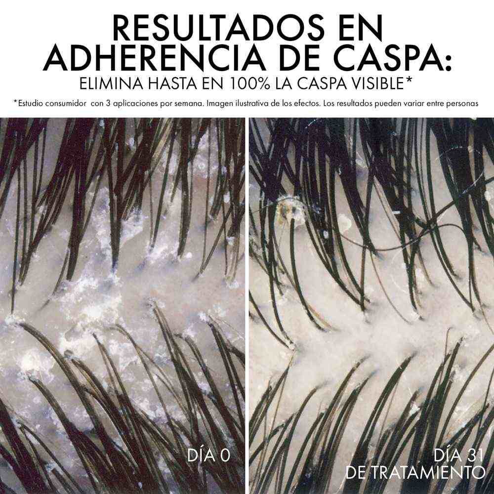 Dercos-Anti-Caspa-DS-ECO-Refill-390ml-imagen-2