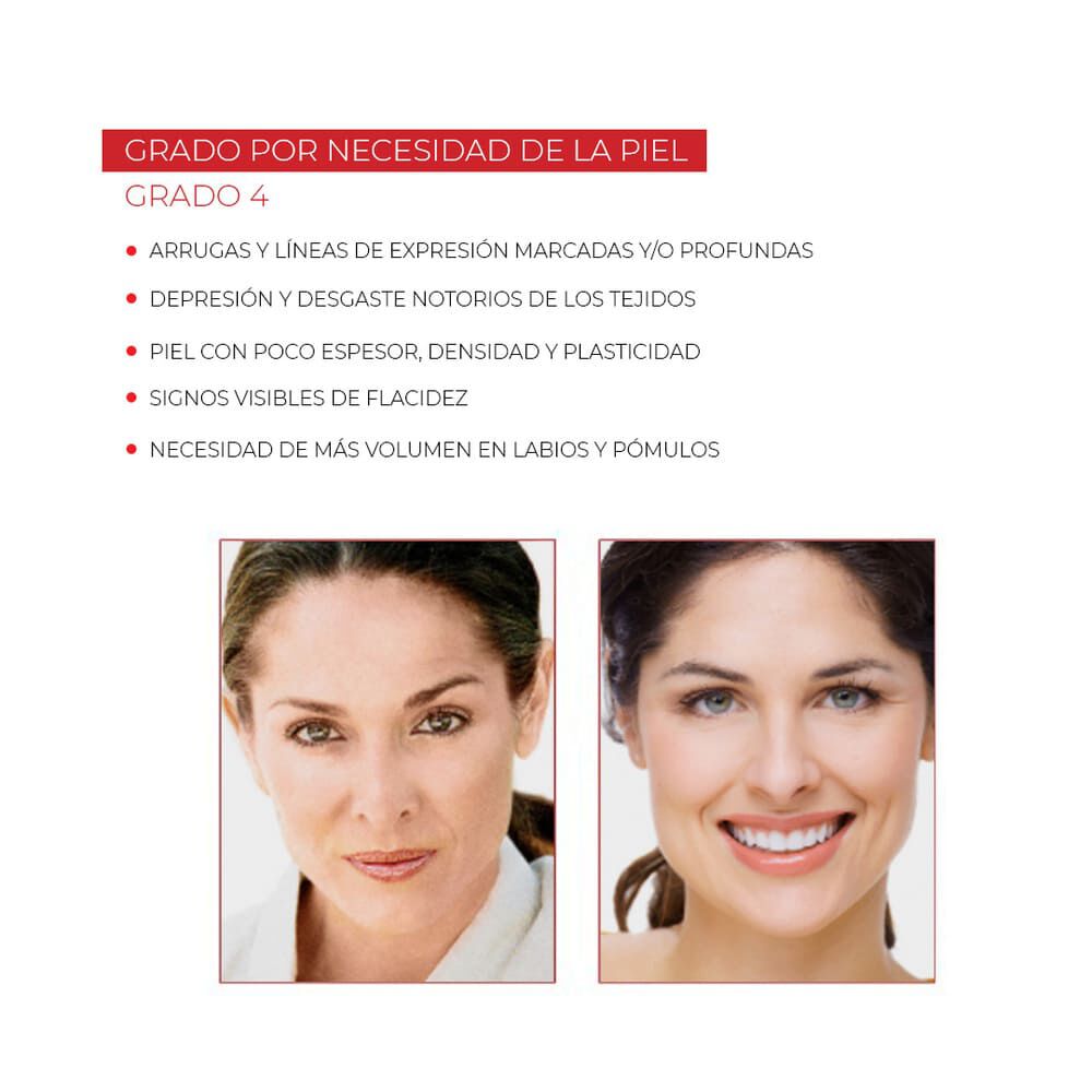 Fillerina12Ha-Eye-Contour-Cream-Grade-4-imagen-4