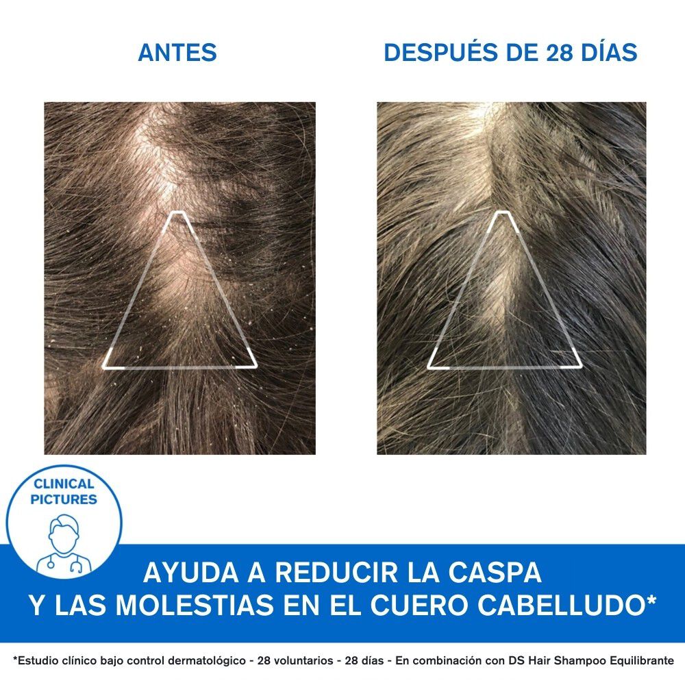 Shampoo-Anticaspa-DS-Hair-200ml-imagen-3