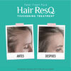 Estimulador-de-Crecimiento-Capilar-Hair-Resq-60-m-imagen-5