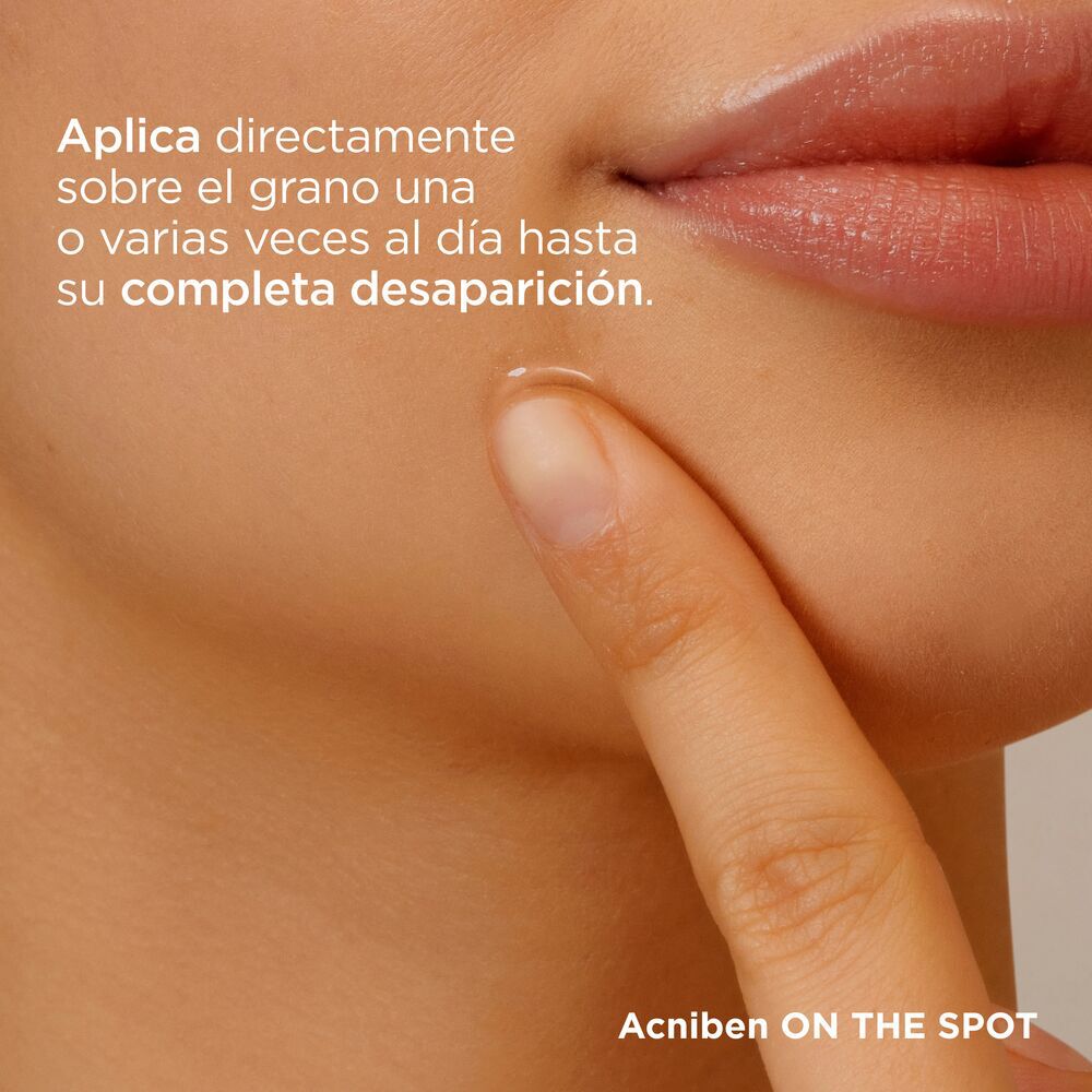 Acniben-On-The-Spot-Secante-Corrector-de-Granos-Faciales-15-mL-imagen-4