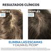 Shampoo-Anticaspa-Severa-DS-Hair-Keratoreductor-150ml-imagen-5