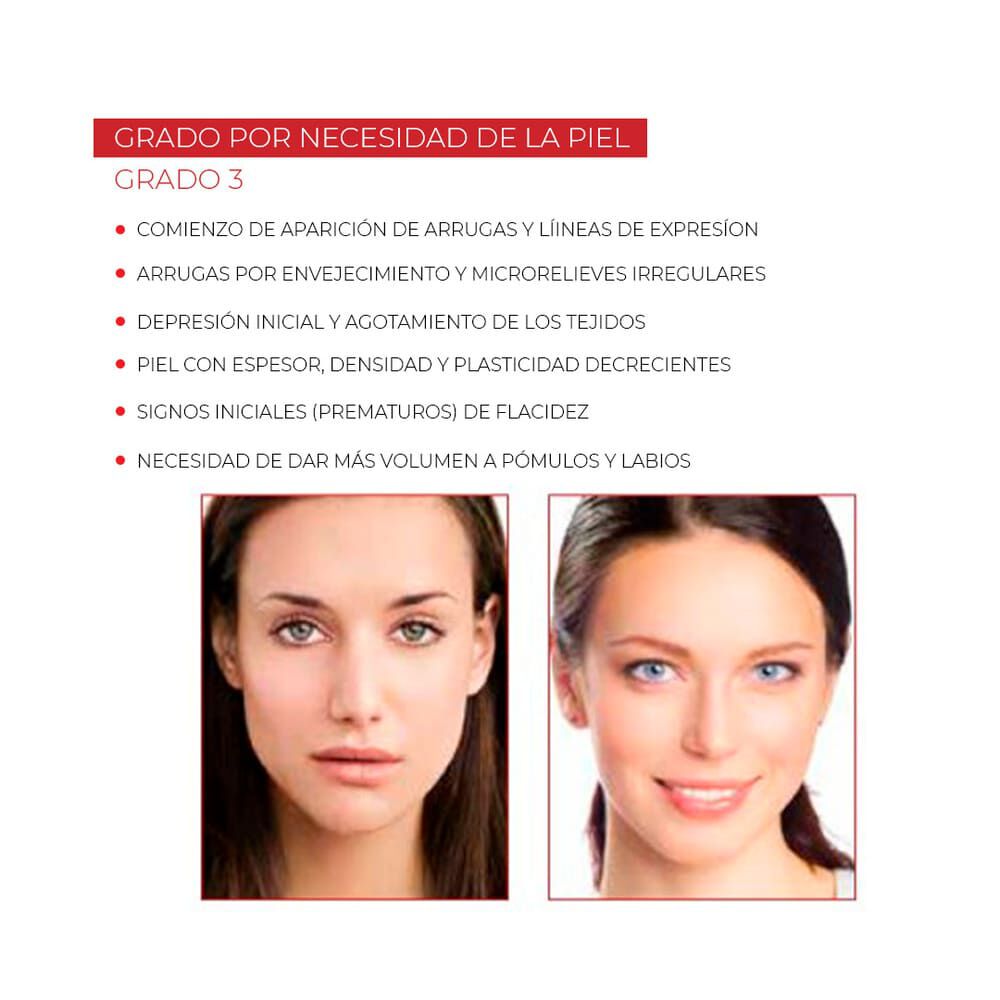 Fillerina12Ha-Intensive-Treatment-Grade-3-imagen-4