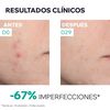 Serum-Anti,imperfecciones-Hys&eacute;ac-Piel-Nueva-30ml-imagen-5