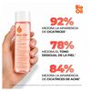 Aceite-Bio-Oil-de-200-mL-imagen-5