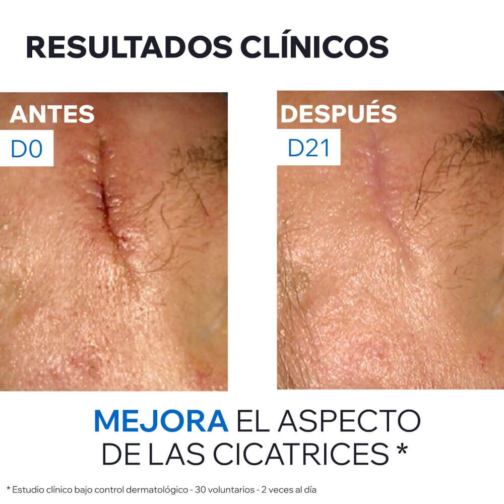Crema-Reparadora-Bari&eacute;derm-CICA-Con-Cobre-y-Zinc-40ml-imagen-5