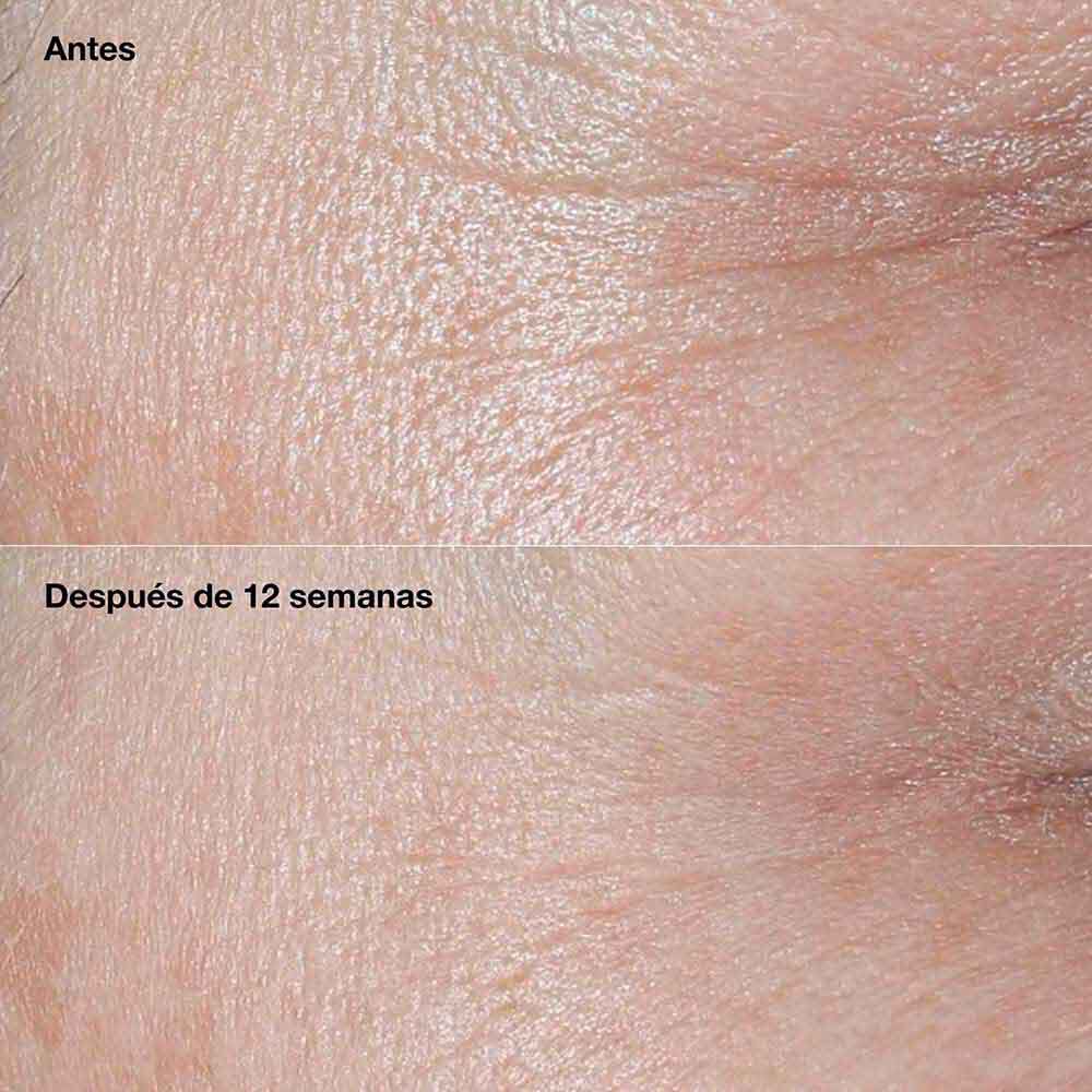 Crema-Correctora-de-Arrugas-Smart-Clinical-Repair&trade;--SPF-30-imagen-5