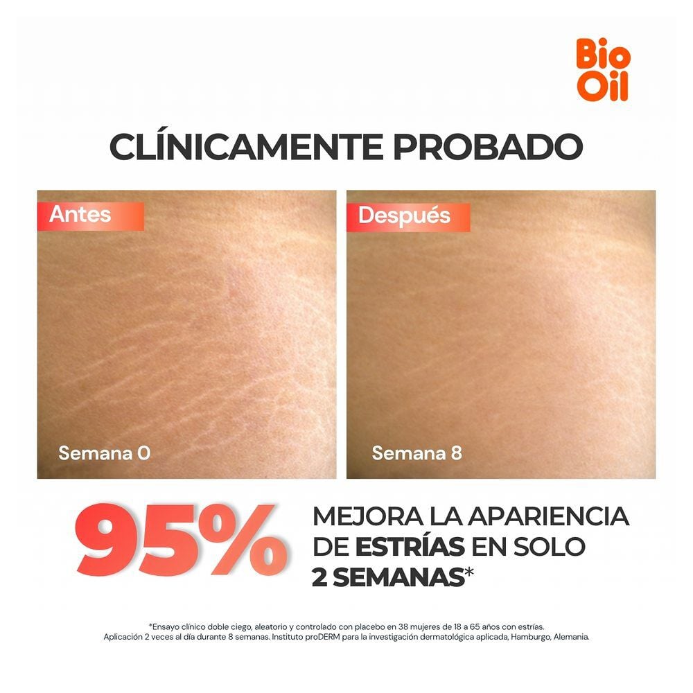 Aceite-Bio-Oil-de-200-mL-imagen-2