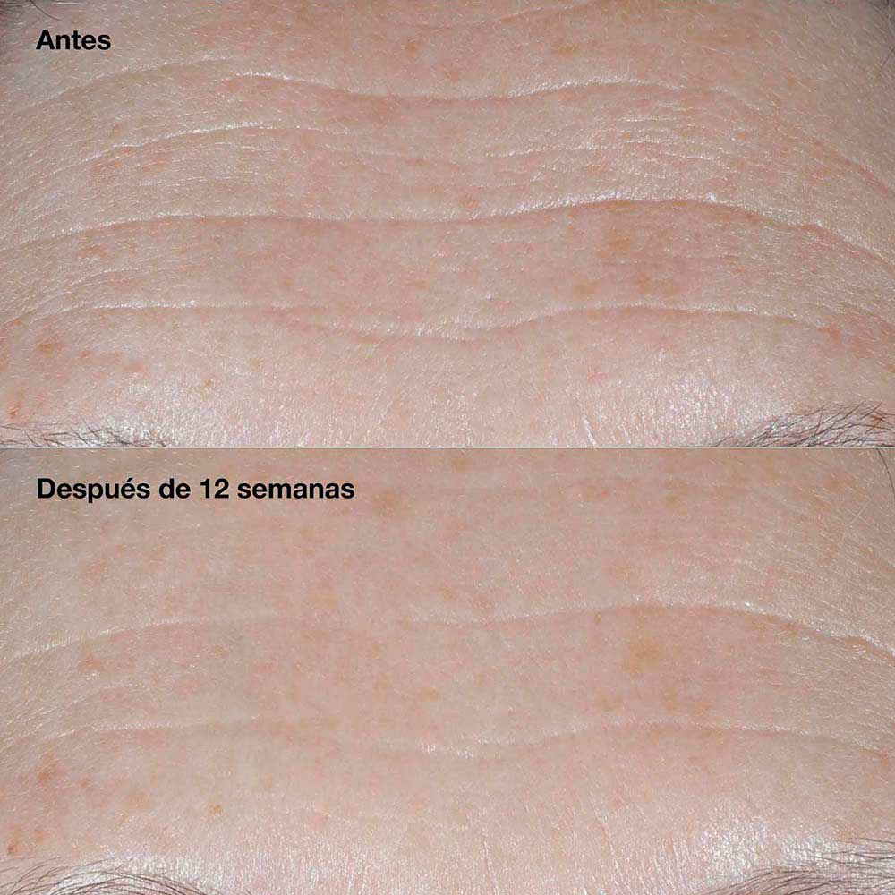 Crema-Correctora-de-Arrugas-Smart-Clinical-Repair&trade;--SPF-30-imagen-6